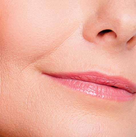 Dermal Fillers