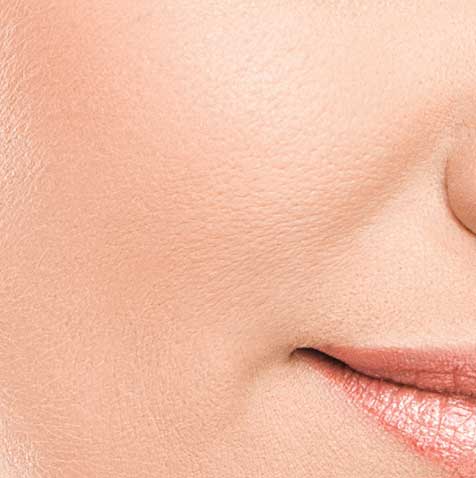 Microneedling